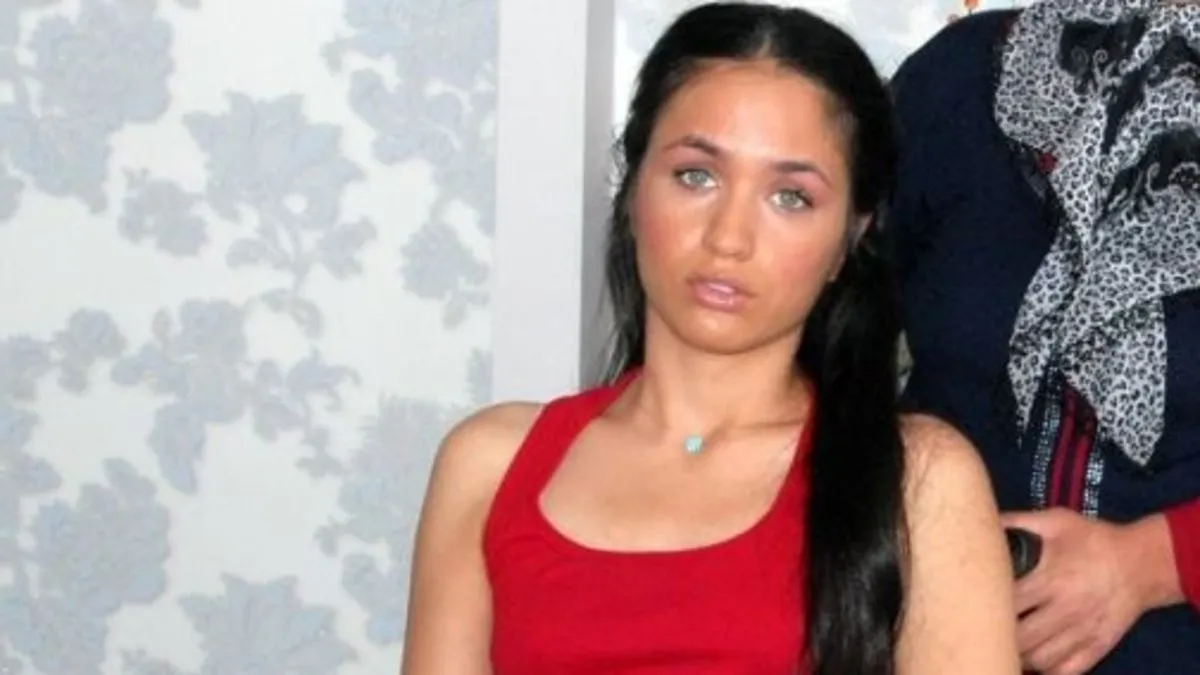 Eski sevgilisi tarafından başından vurulunca hayatı tamamen değişti! İşte Sibel Can’ın desteklediği Mutlu Kaya’nın son hali!