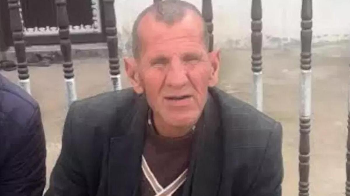 Cipin çarptığı sosyal medya fenomeni İsmail Öztekin hayatını kaybetti